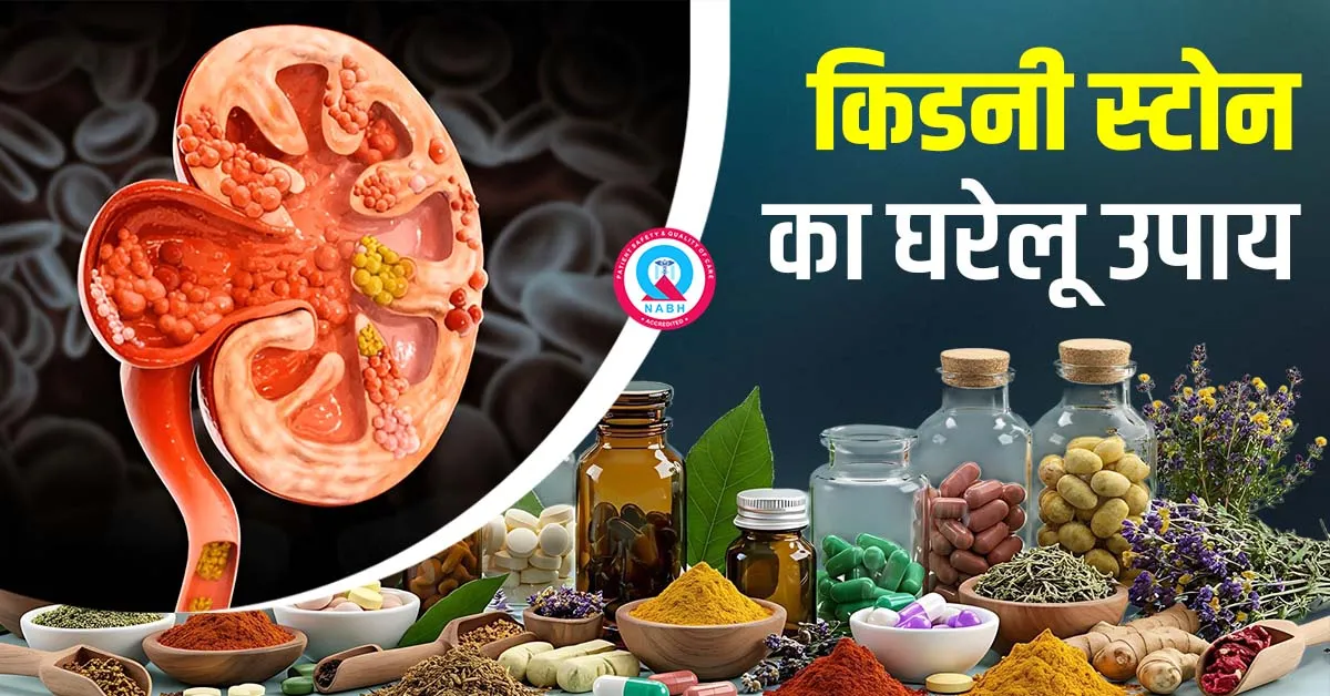 किडनी-स्टोन-का-घरेलू-उपाय